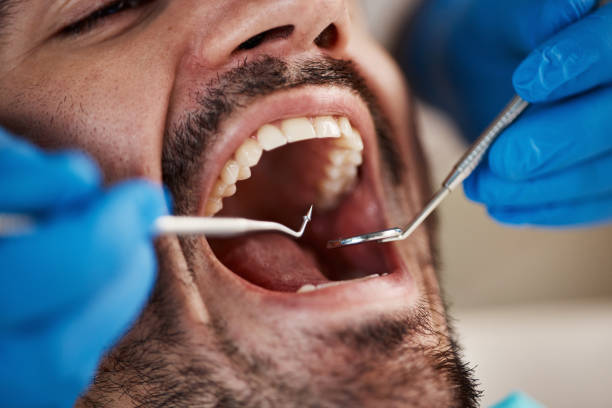Best Emergency Gum Treatment in Roanoke, IL
